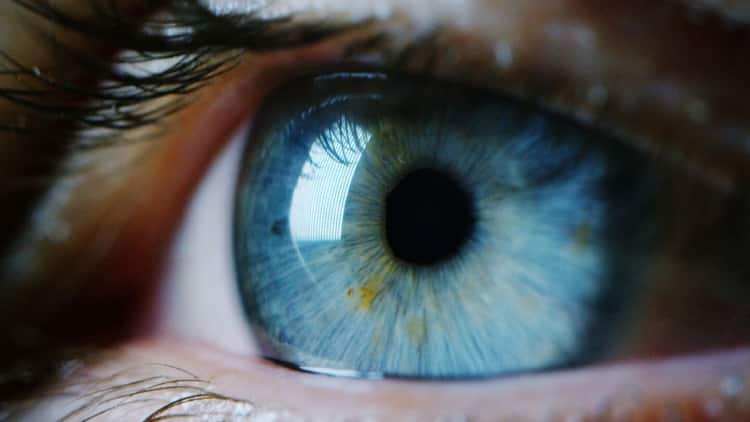 Your eye colour can reveal facts about your health