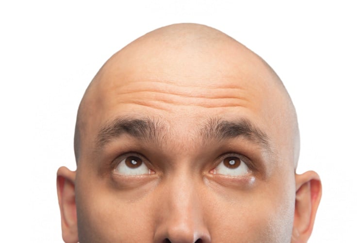 Scientists Have Discovered A Potential Cure For Baldness